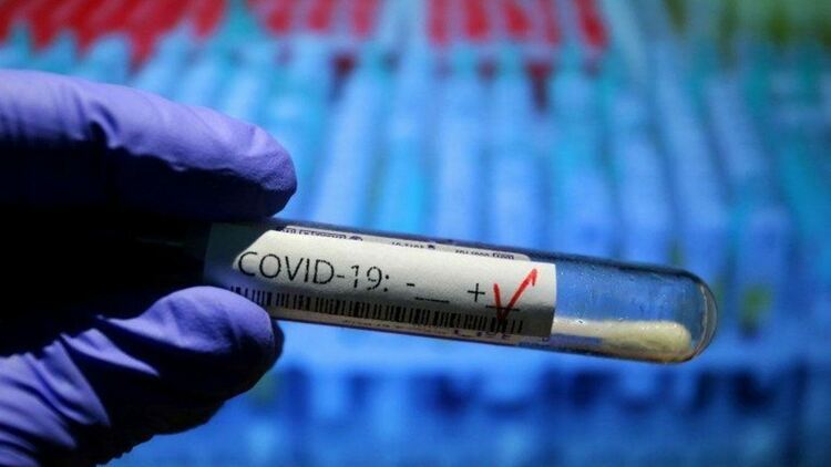 817 са новите случаи на COVID-19 в област Пловдив за почивните дни 