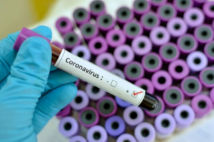 286 са новите случаи на COVID-19 в област Пловдив за почивните дни 