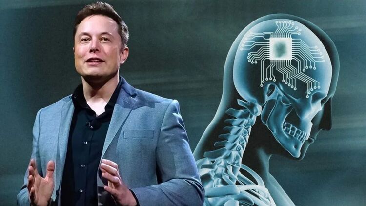 Компанията Neuralink на Мъск набира доброволци за имплантиране на чип в мозъка